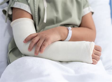 Is a Broken Arm a Catastrophic Injury? | Maginnis Howard