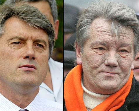 MOS: The Poisoning of Viktor Yushchenko