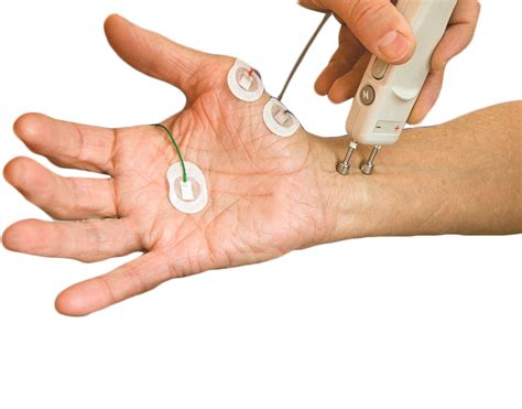 EMG/NCV
