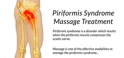 What Is Piriformis Syndrome? Example – Grow Health