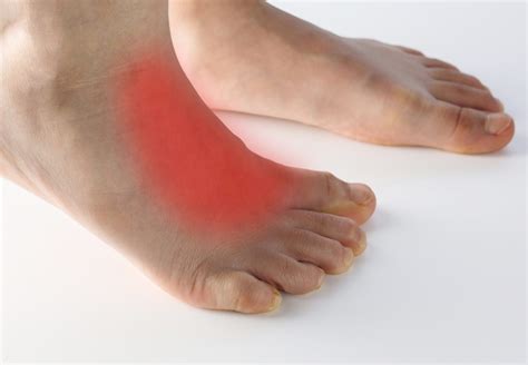 Morton’s Neuroma - Brisbane Foot Clinic