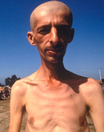 Srebrenica Genocide Blog: BOSNIAN GENOCIDE: UNSEEN BRUTALITY SINCE NAZI-ERA