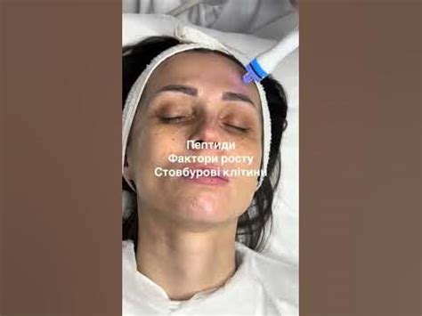 Як оновити шкіру? Від лущення, комедонів, почервоніння, зморшок ...