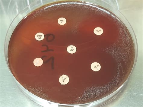 Streptococcus sanguinis-Introduction, Morphology, Pathogenicity, Lab