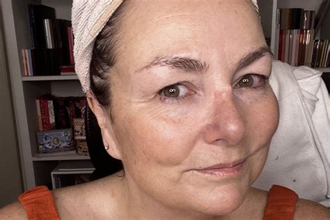 Here's what happened when I posted my unfiltered skin.