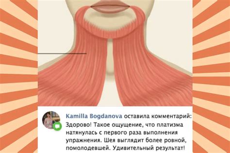 Платизма Мышца Где Находится Фото — Фото Картинки