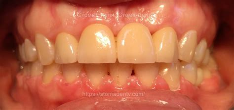 Photo gallery – orthodontist (photo works)