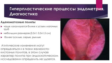 Гиперплазия эндометрия. Клиника. Диагностика - презентация онлайн