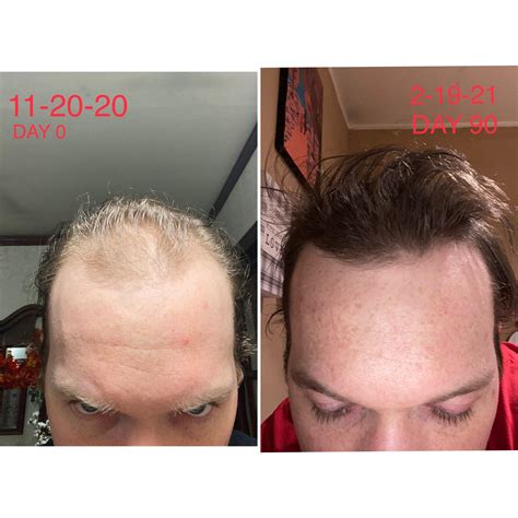 Souirensu It Works: My Results After [Number] Months! - 5raf4rm