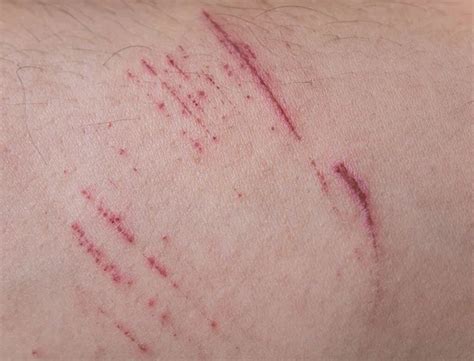 Scratches the skin Images - Search Images on Everypixel