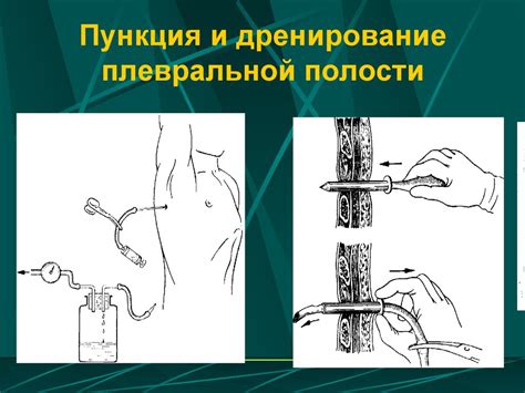 Травма груди - презентация онлайн