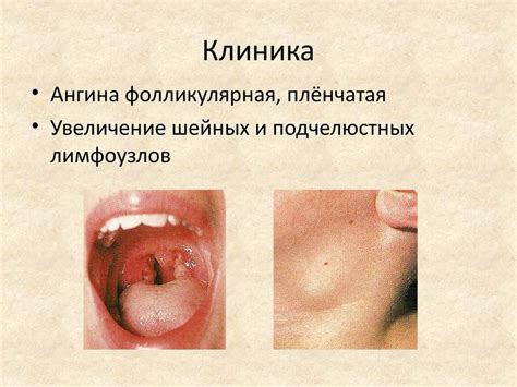 Профилактические и противоэпидемические мероприятия в детских ...