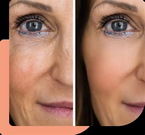 Plasma Rico en Plaquetas – ARS Medica Clínica de Ozono y Plasma