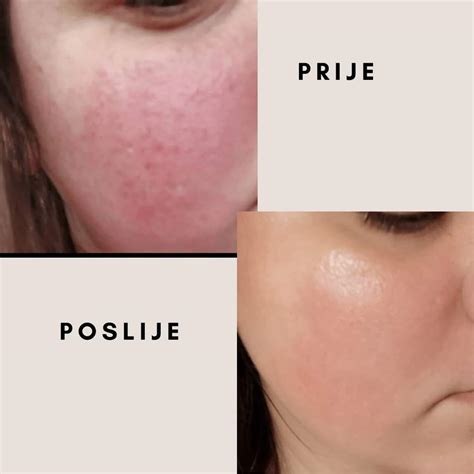 DERMAWISE : r/Skincare_Addiction