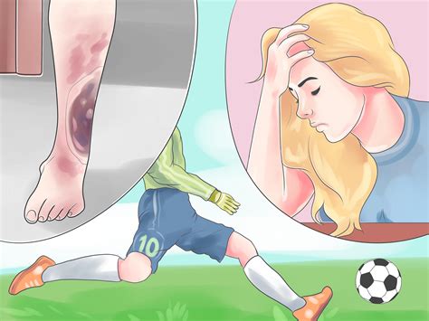 4 Ways to Heal a Hematoma at Home - wikiHow