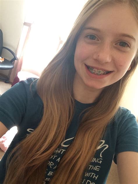 Braces 😁😁😁😁 | Long hair styles, Hair styles, Hair