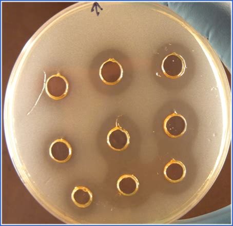 lyso secalim web site