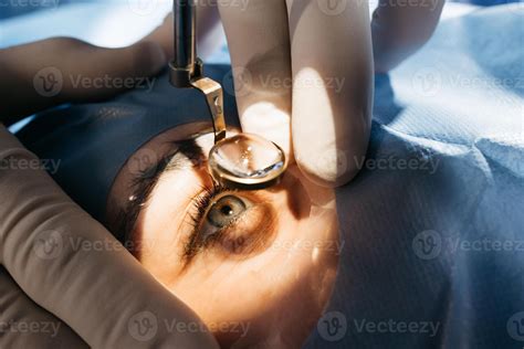 Vision correction with microscope. Surgeon's hands in gloves performing