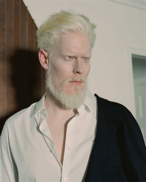Funny Albino Men