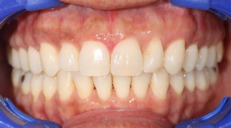 Gallery - Smiles & Sonrisas Family Dentistry