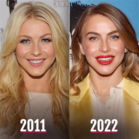 Julianne Hough Wikifeet: Before & After – The Transformation - 2ocvp5r