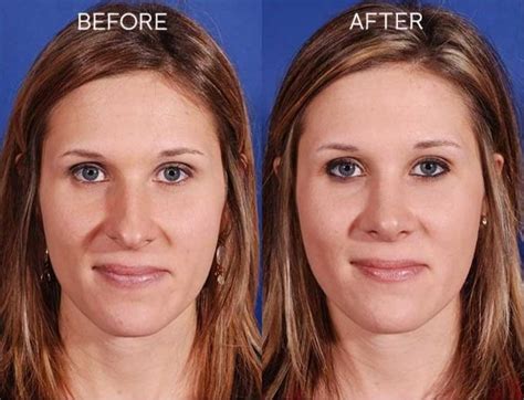 Title — SKY Facial Plastic Surgery