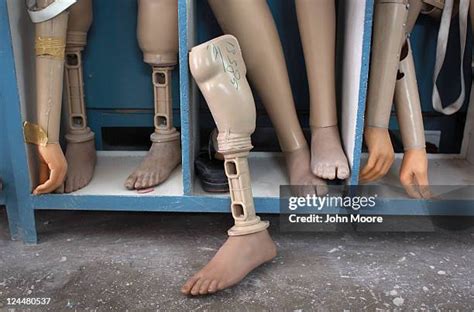 Congenital Amputation Stock-Fotos und Bilder - Getty Images