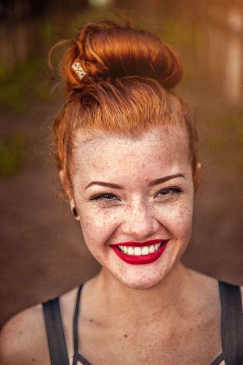 How To Remove Red Spots On Skin?