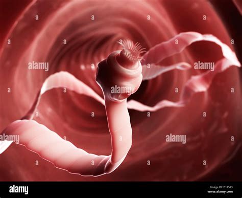 Le ténia, artwork Photo Stock - Alamy