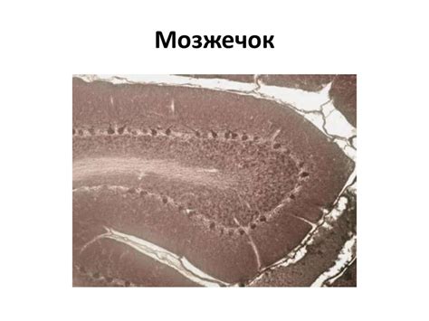 Артерия эластического типа – аорта - online presentation
