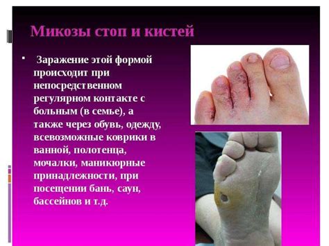 Плесневые грибы и дрожжи - презентация онлайн