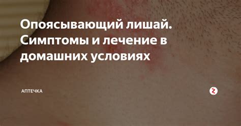 Опоясывающий лишай: лечение в домашних условиях