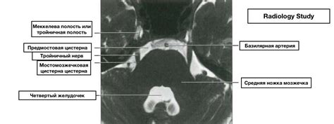 Черепные нервы. МРТ анатомия — 24Radiology.ru
