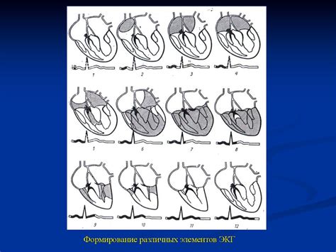 Клиническая электрокардиография. Нормальная электрокардиограмма ...