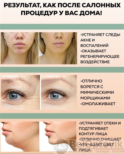 Микротоковый лифтинг-массажер для лица и шеи Intense Pulsed Light (IPL ...