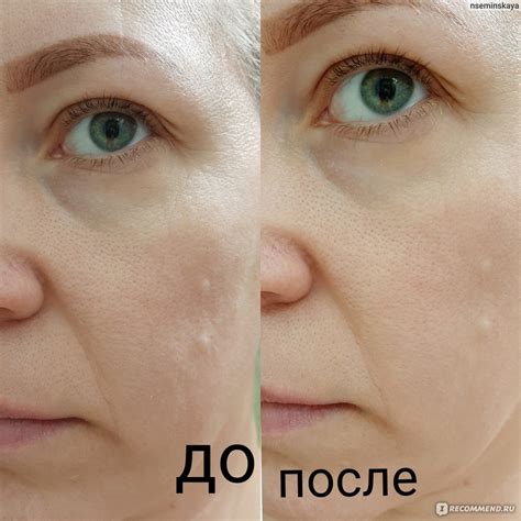 Гель-филлер для лица NOVOSVIT Морской коллаген с микрокапсулами ...
