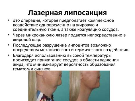 Липосакция - презентация онлайн