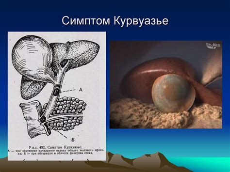 Острые хирургические заболевания брюшной полости - online presentation