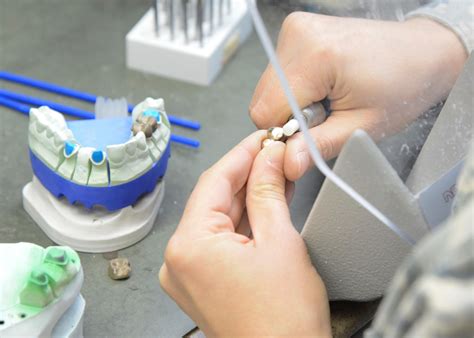 Dental Laboratory Technician Medical Term at Sandra Slavin blog