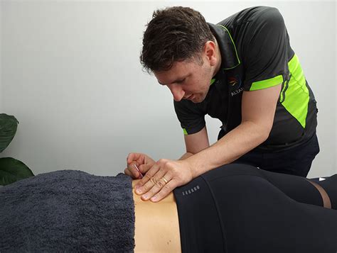 dry needling adelaide physio services