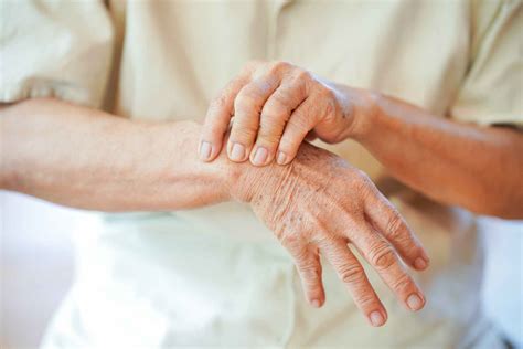 New partnership aims to revolutionize rheumatoid arthritis treatment ...