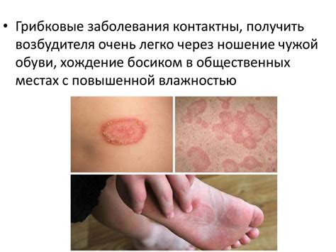 Санитария и гигиена парикмахерских услуг: Кожные заболевания ...