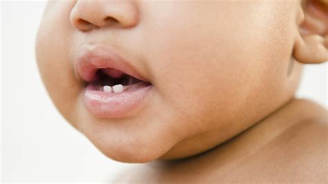 When do babies start teething? The signs and symptoms