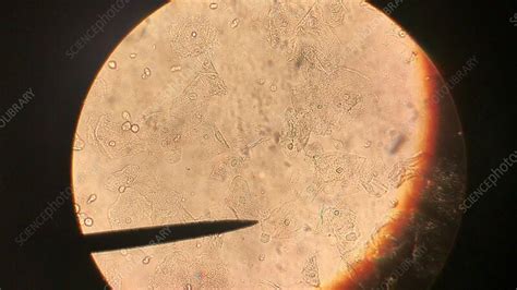Trichomonas vaginalis parasite, light microscopy - Stock Video Clip ...