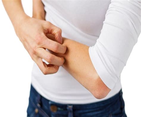 Study Finds Vaseline Can Ward Off Eczema | Newsmax.com