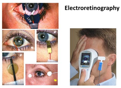 Week 9. ElectroRetinoGram — Neurophysiology Lab