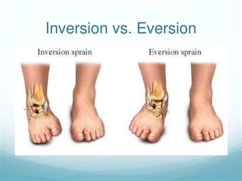 PPT - Achilles & Ankle Injuries PowerPoint Presentation, free download ...