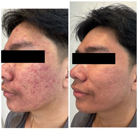 ALO Dermatology | Cebu City