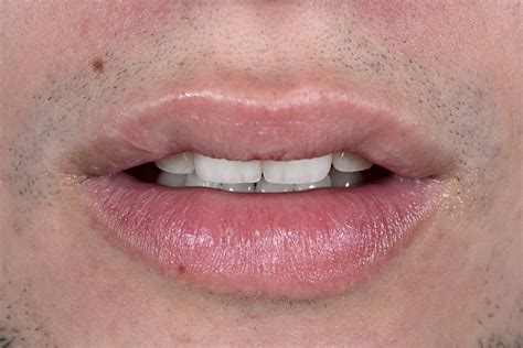 Multidisciplinary Approach To Facial And Dental Planning 1e 2