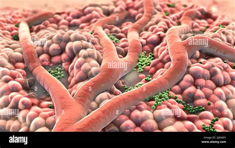Pus Cells High Resolution Stock Photography and Images - Alamy